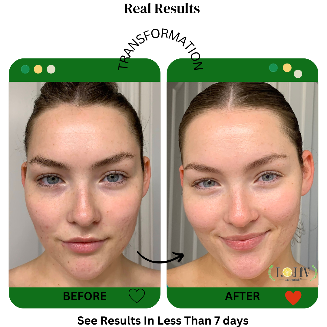 PREMIUM 100% Vegan Hydrating Facial Cleanser, Moisturizing Face Wash For All Skin Types, Hyaluronic Acid + Ginger Water + Lactic acid + Glycolic acid, Fragrance Free & Paraben Free, Non-Drying Oil Control Face Wash.