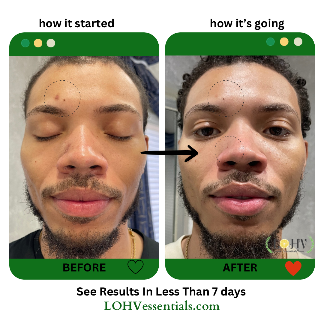 PREMIUM 100% Vegan Hydrating Facial Cleanser, Moisturizing Face Wash For All Skin Types, Hyaluronic Acid + Ginger Water + Lactic acid + Glycolic acid, Fragrance Free & Paraben Free, Non-Drying Oil Control Face Wash.