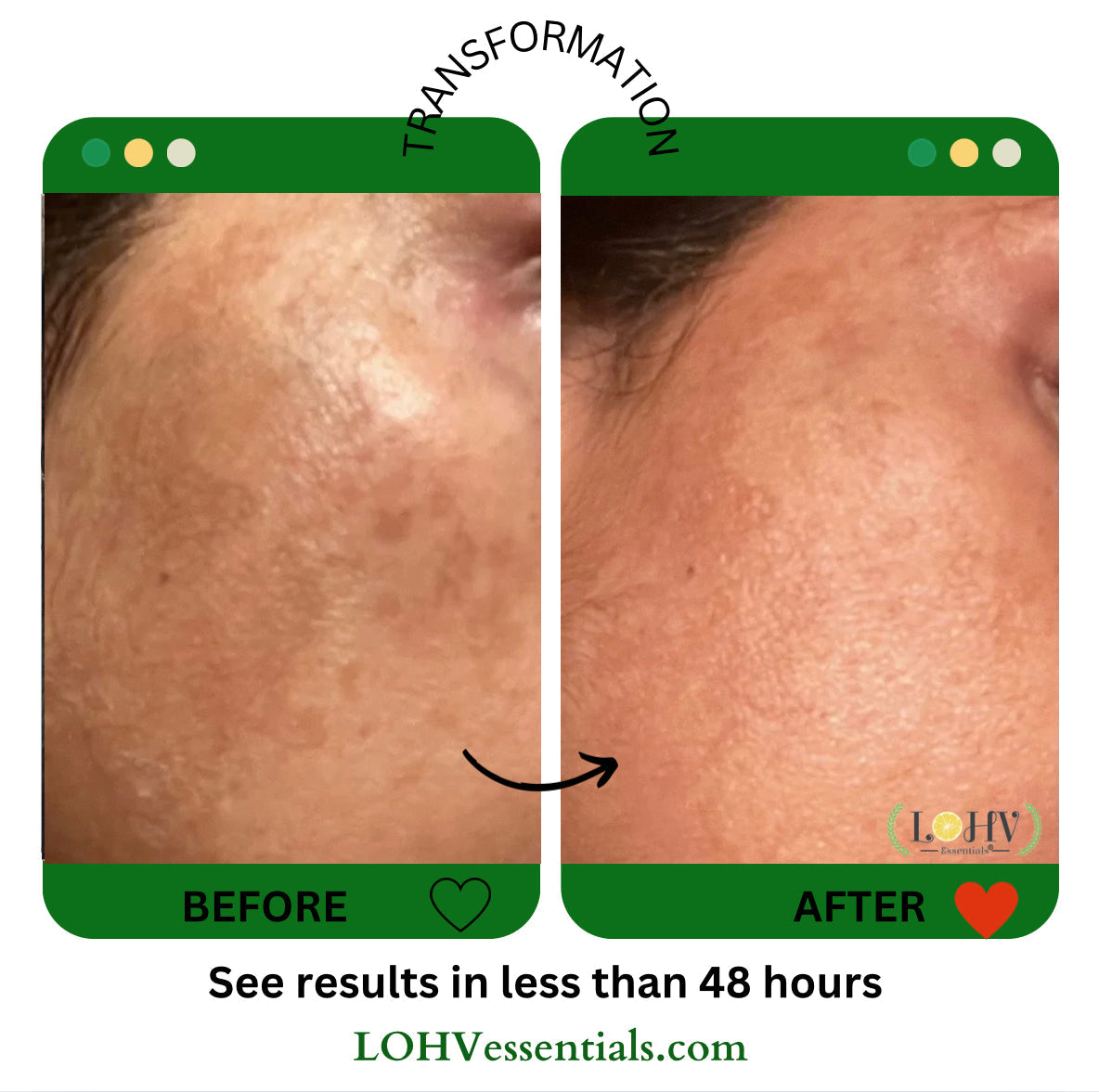 PREMIUM 100% Vegan Hydrating Facial Cleanser, Moisturizing Face Wash For All Skin Types, Hyaluronic Acid + Ginger Water + Lactic acid + Glycolic acid, Fragrance Free & Paraben Free, Non-Drying Oil Control Face Wash.