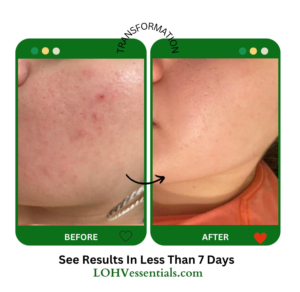 PREMIUM 100% Vegan Hydrating Facial Cleanser, Moisturizing Face Wash For All Skin Types, Hyaluronic Acid + Ginger Water + Lactic acid + Glycolic acid, Fragrance Free & Paraben Free, Non-Drying Oil Control Face Wash.